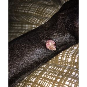 What-Causes-Warts